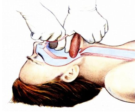 ▲观察口腔有无异物（见到异物才清除）