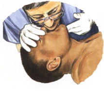 ▲口对口人工呼吸