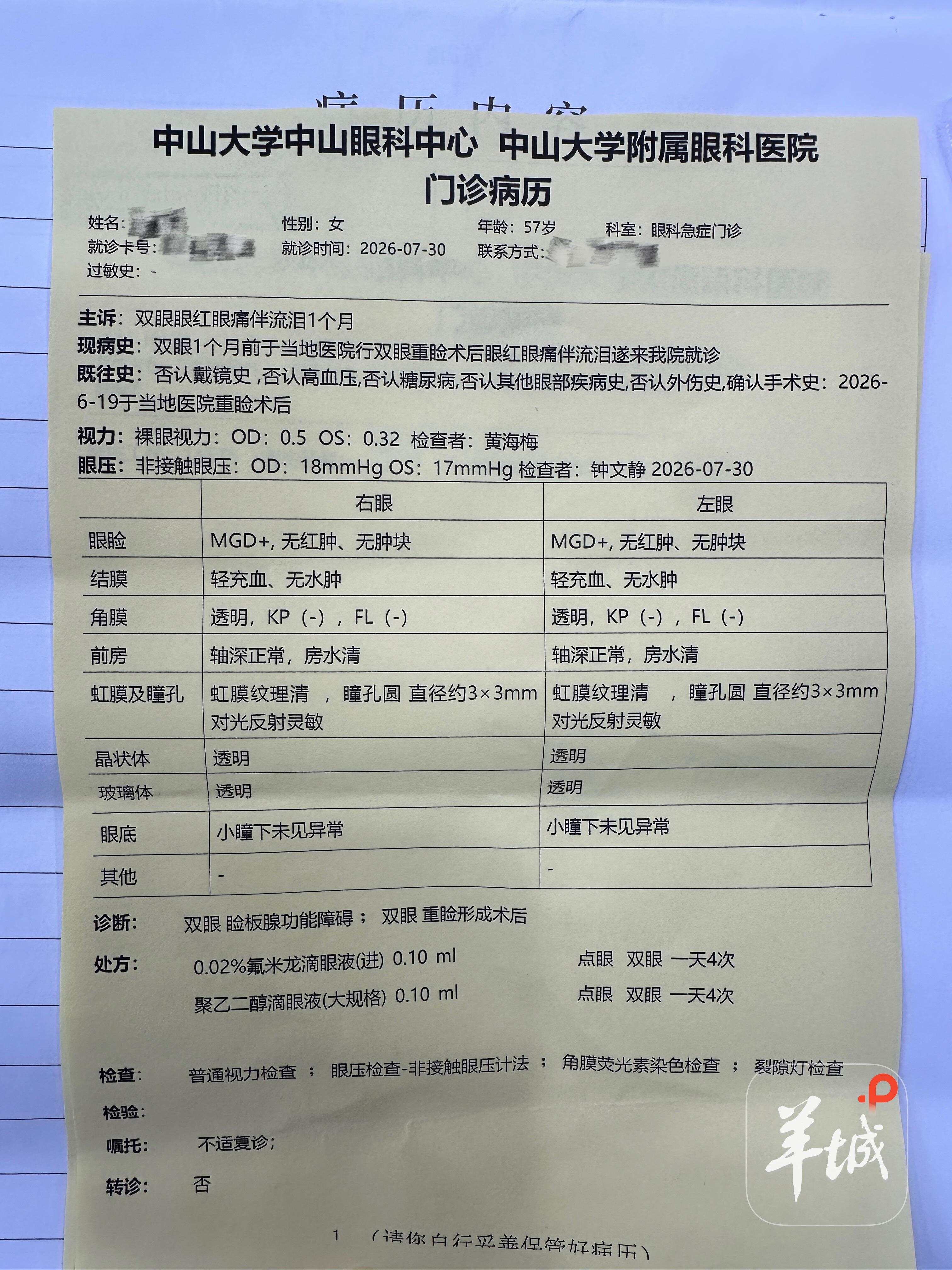 郑大姐7月30日在中山大学中山眼科中心的门诊病历 郑大姐7月30日在中山大学中山眼科中心的门诊病历