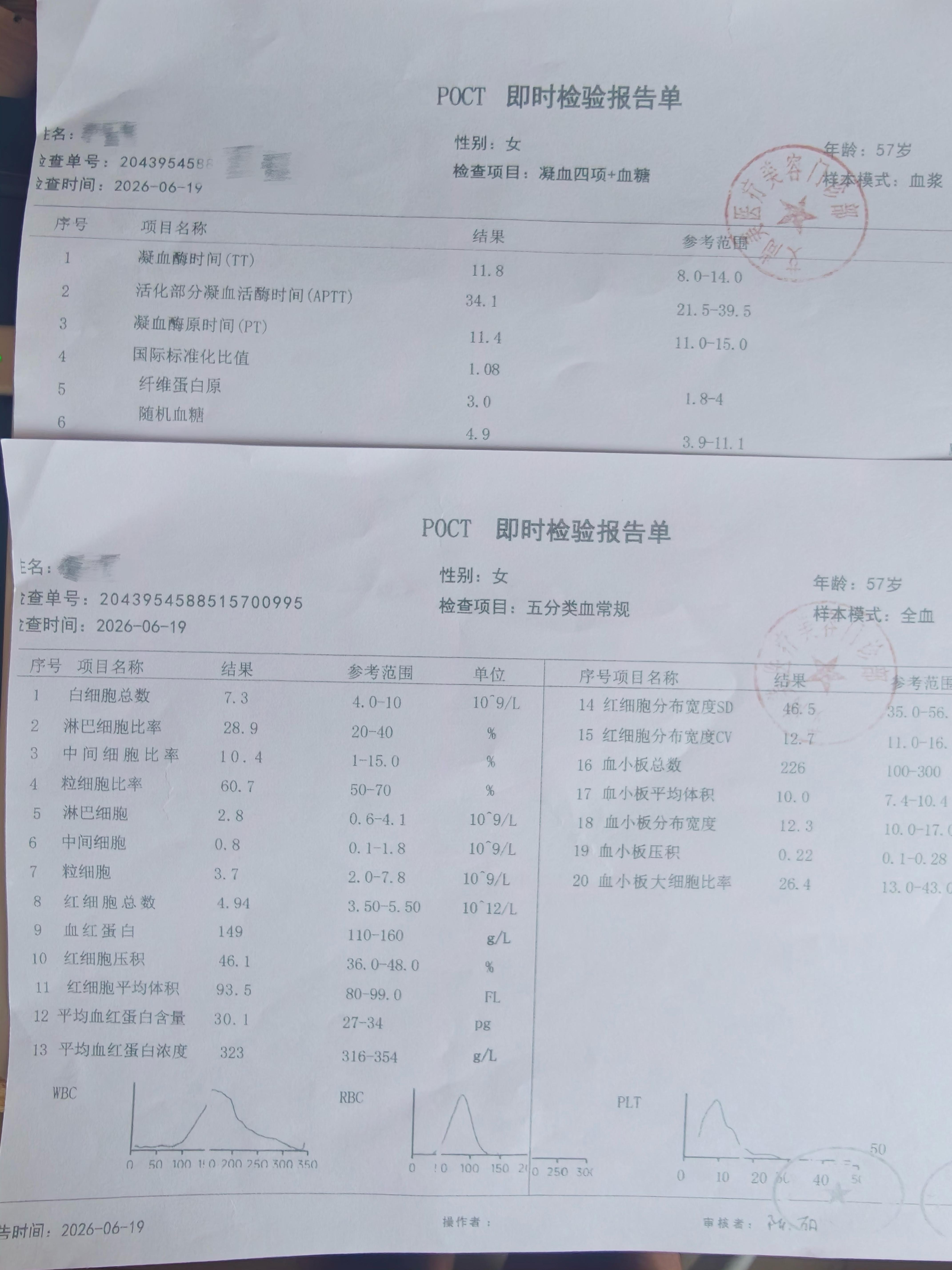 郑大姐6月19日手术当日,机构提供的所有术前检查结果,其中未包含传染病相关筛查 郑大姐6月19日手术当日,机构提供的所有术前检查结果,其中未包含传染病相关筛查